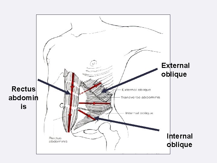 External oblique Rectus abdomin is Internal oblique 
