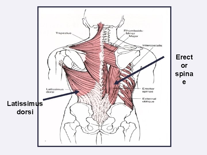 Erect or spina e Latissimus dorsi 