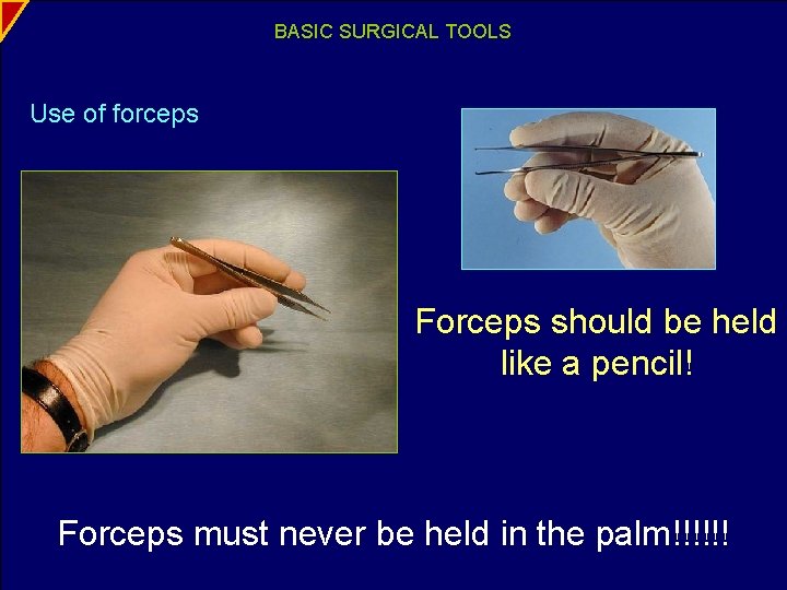 BASIC SURGICAL TOOLS Use of forceps Forceps should be held like a pencil! Forceps