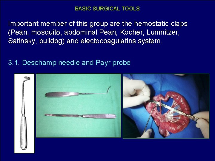 BASIC SURGICAL TOOLS Important member of this group are the hemostatic claps (Pean, mosquito,