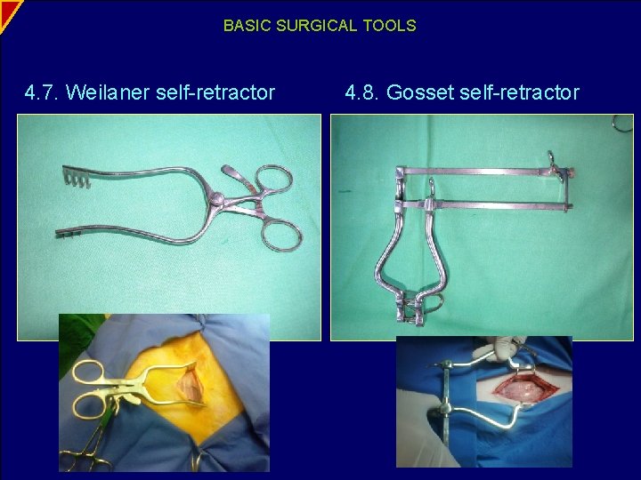 BASIC SURGICAL TOOLS 4. 7. Weilaner self-retractor 4. 8. Gosset self-retractor 