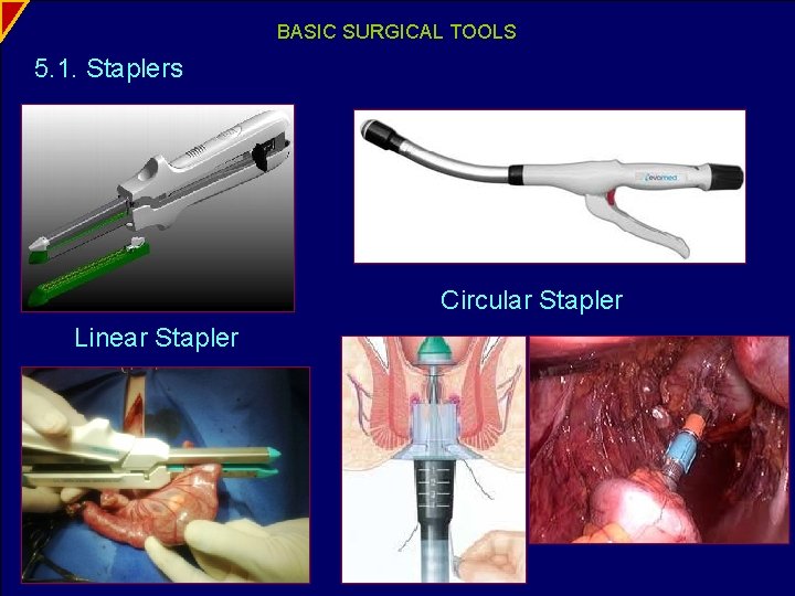 BASIC SURGICAL TOOLS 5. 1. Staplers Circular Stapler Linear Stapler 