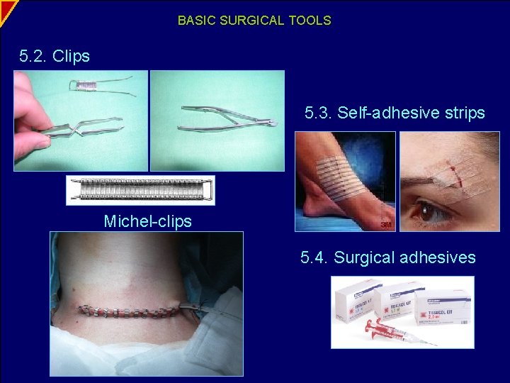 BASIC SURGICAL TOOLS 5. 2. Clips 5. 3. Self-adhesive strips Michel-clips 5. 4. Surgical