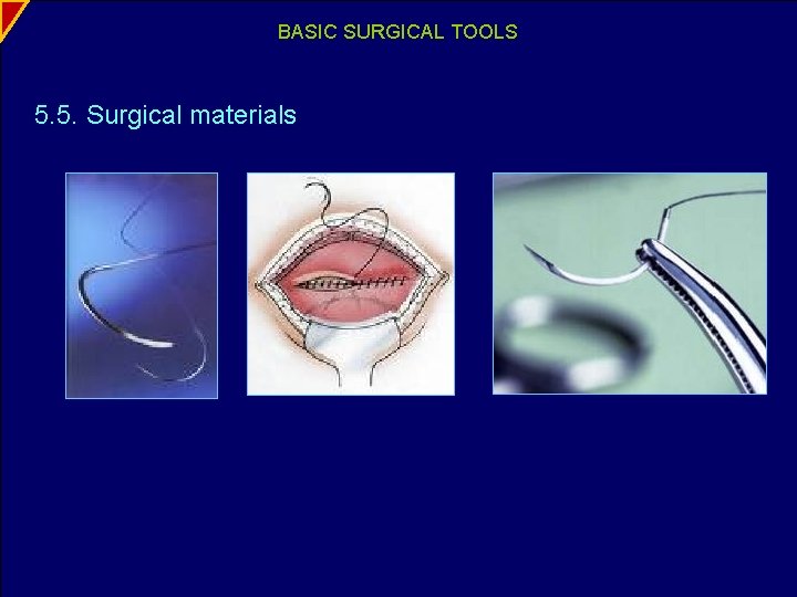 BASIC SURGICAL TOOLS 5. 5. Surgical materials 