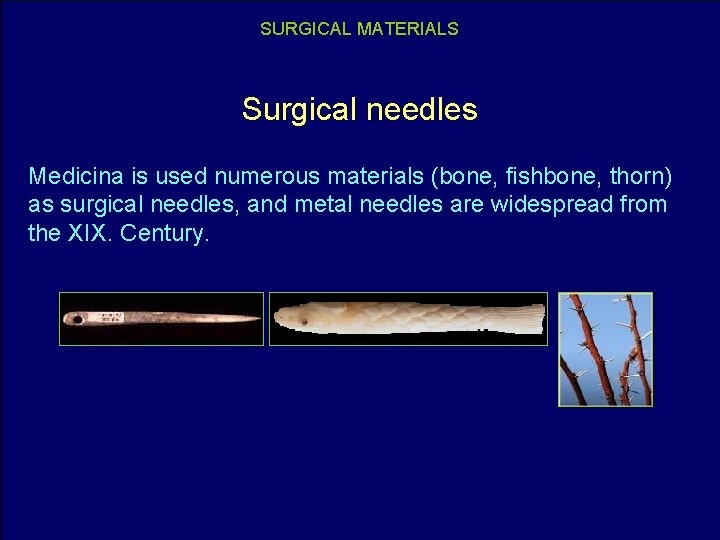 SURGICAL MATERIALS Surgical needles Medicina is used numerous materials (bone, fishbone, thorn) as surgical