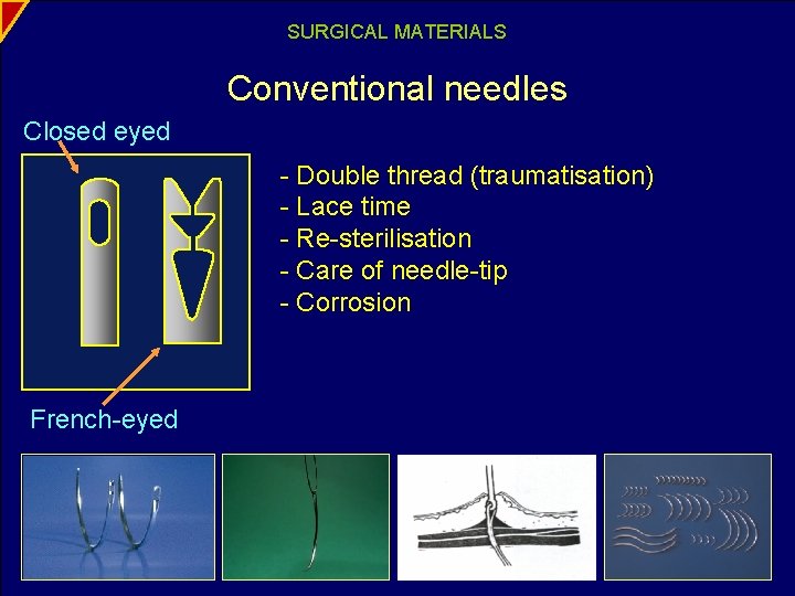 SURGICAL MATERIALS Conventional needles Closed eyed - Double thread (traumatisation) - Lace time -