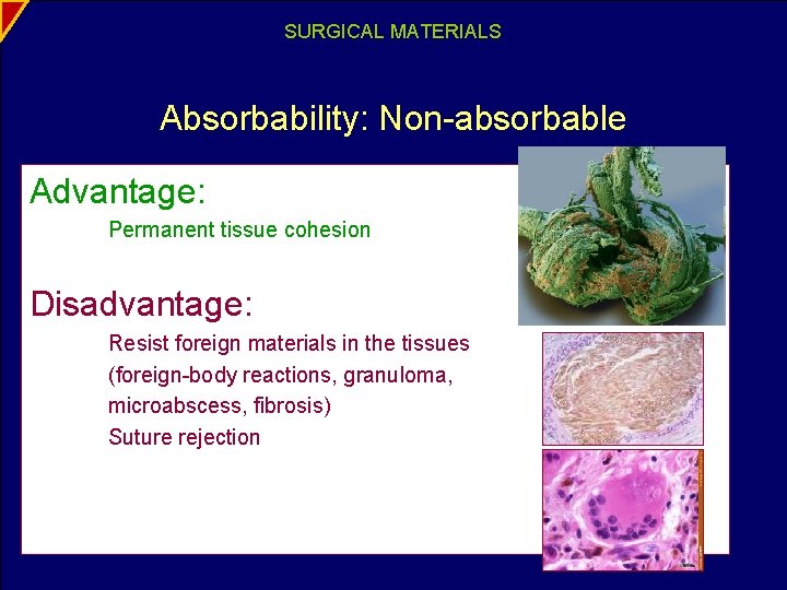 SURGICAL MATERIALS Absorbability: Non-absorbable Advantage: Permanent tissue cohesion Disadvantage: Resist foreign materials in the