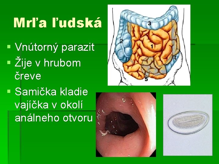 Mrľa ľudská § Vnútorný parazit § Žije v hrubom čreve § Samička kladie vajíčka