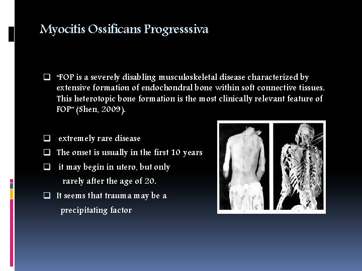 Myocitis Ossificans Progresssiva q “FOP is a severely disabling musculoskeletal disease characterized by extensive