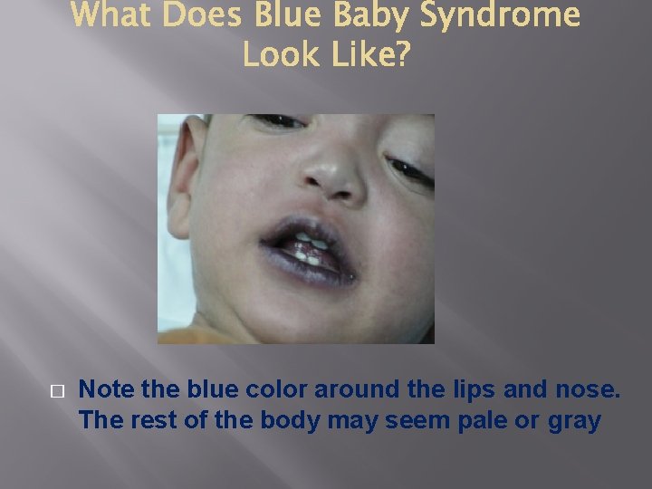 � Note the blue color around the lips and nose. The rest of the