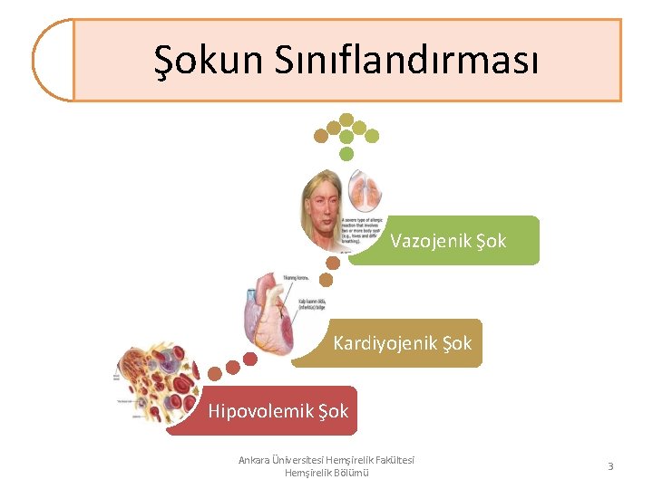 Şokun Sınıflandırması Vazojenik Şok Kardiyojenik Şok Hipovolemik Şok Ankara Üniversitesi Hemşirelik Fakültesi Hemşirelik Bölümü