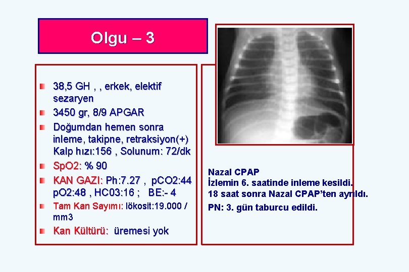 Olgu – 3 38, 5 GH , , erkek, elektif sezaryen 3450 gr, 8/9