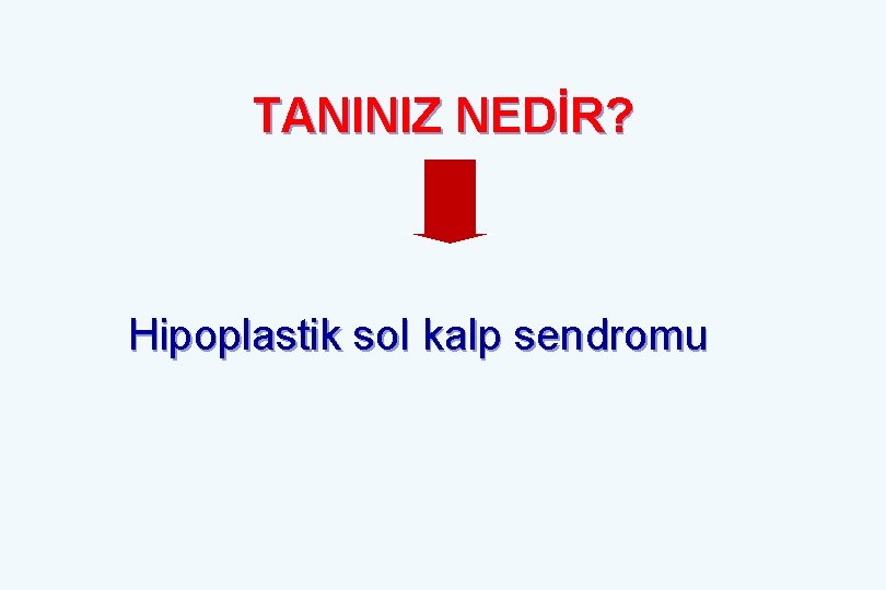 TANINIZ NEDİR? Hipoplastik sol kalp sendromu 