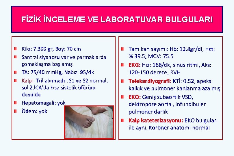 FİZİK İNCELEME VE LABORATUVAR BULGULARI Kilo: 7. 300 gr, Boy: 70 cm Santral siyanozu