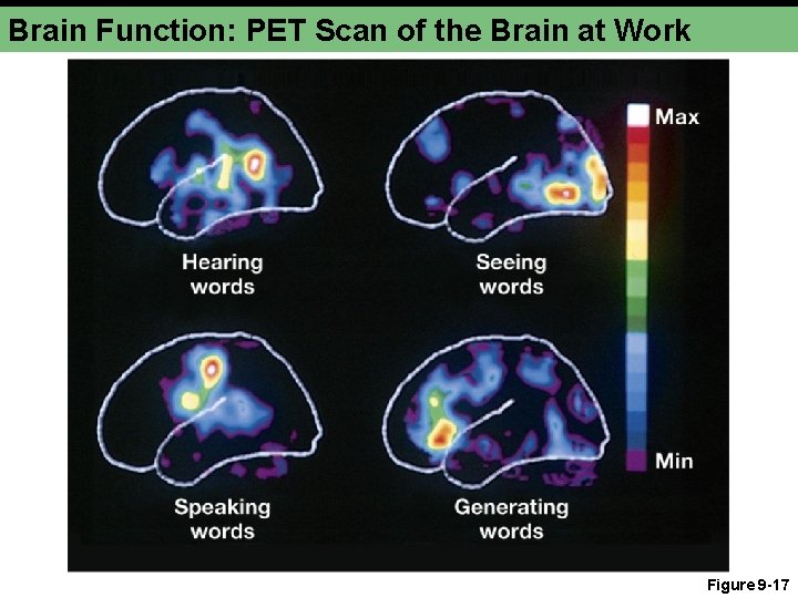 Brain Function: PET Scan of the Brain at Work Figure 9 -17 
