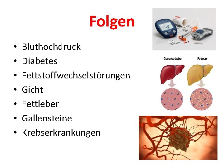 Folgen • • Bluthochdruck Diabetes Fettstoffwechselstörungen Gicht Fettleber Gallensteine Krebserkrankungen 