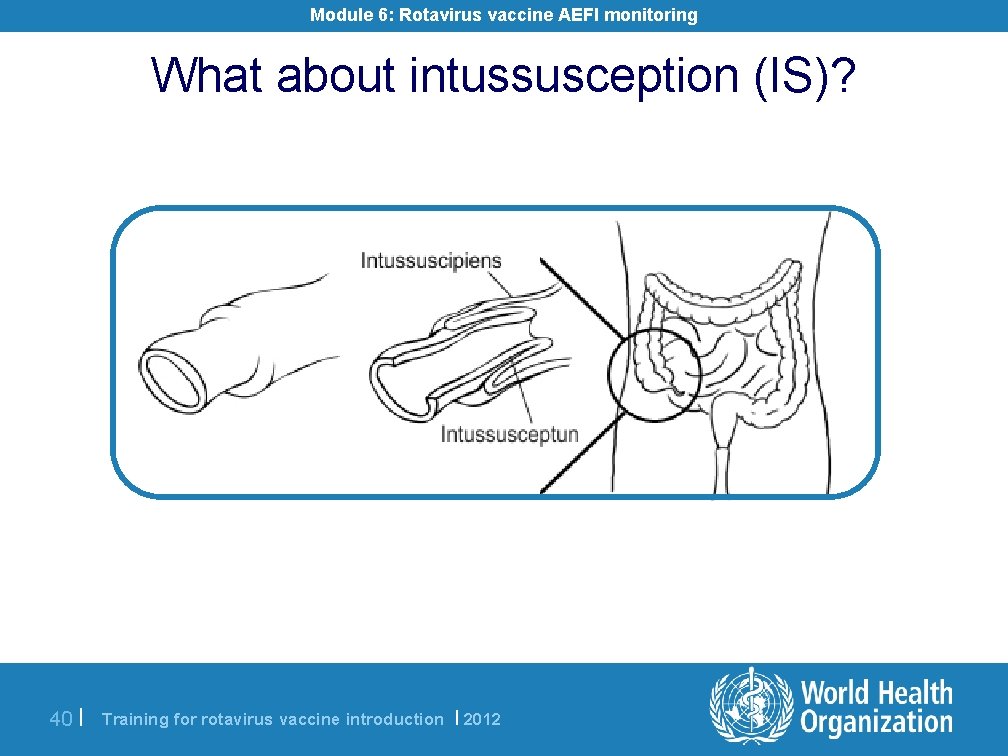 Module 6: Rotavirus vaccine AEFI monitoring What about intussusception (IS)? 40 | Training for