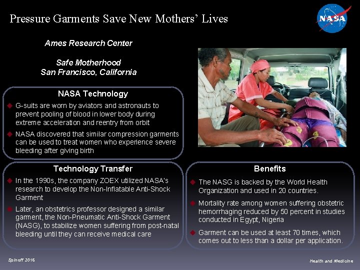 Pressure Garments Save New Mothers’ Lives Ames Research Center Safe Motherhood San Francisco, California