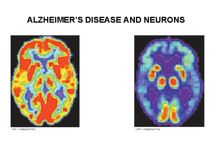 ALZHEIMER’S DISEASE AND NEURONS 