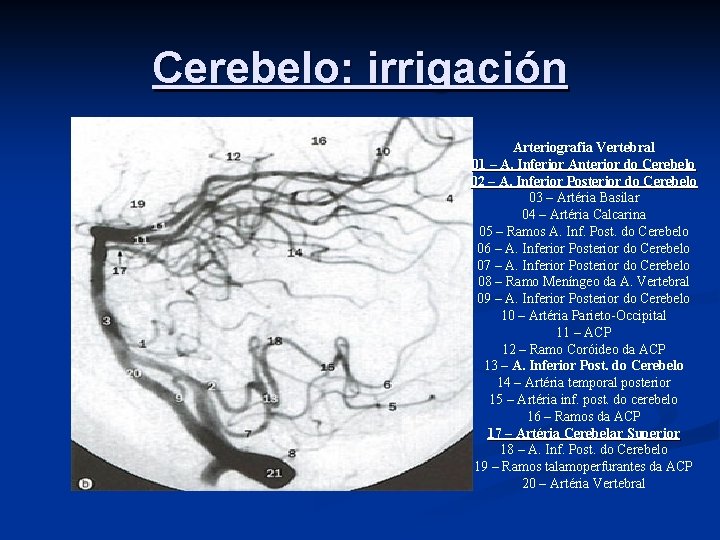 Cerebelo: irrigación Arteriografia Vertebral 01 – A. Inferior Anterior do Cerebelo 02 – A.