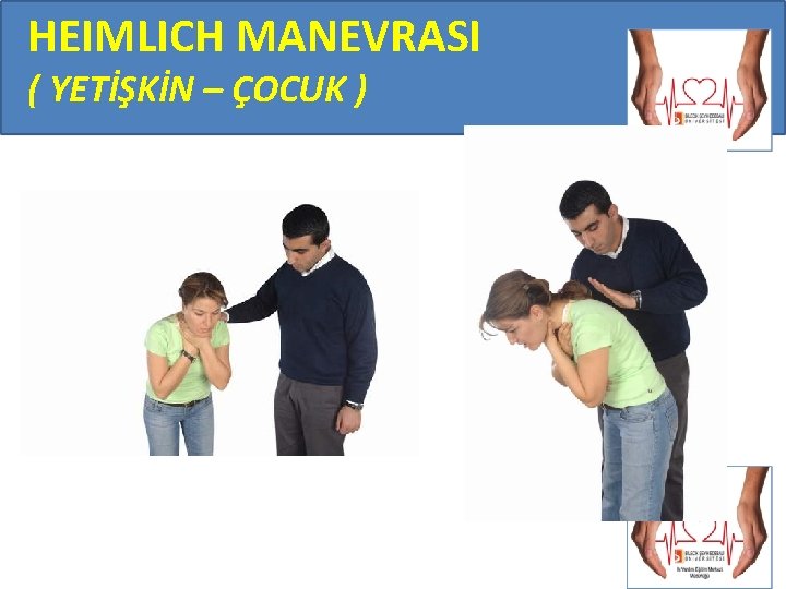 HEIMLICH MANEVRASI ( YETİŞKİN – ÇOCUK ) 