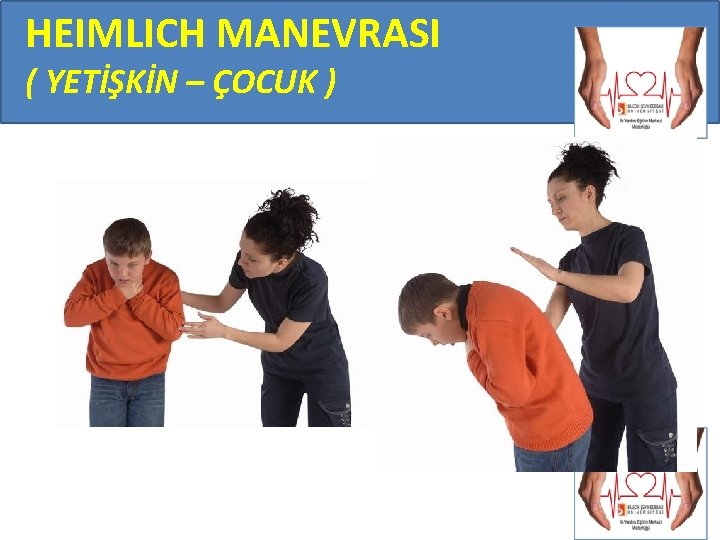 HEIMLICH MANEVRASI ( YETİŞKİN – ÇOCUK ) 