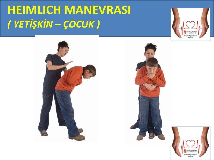 HEIMLICH MANEVRASI ( YETİŞKİN – ÇOCUK ) 
