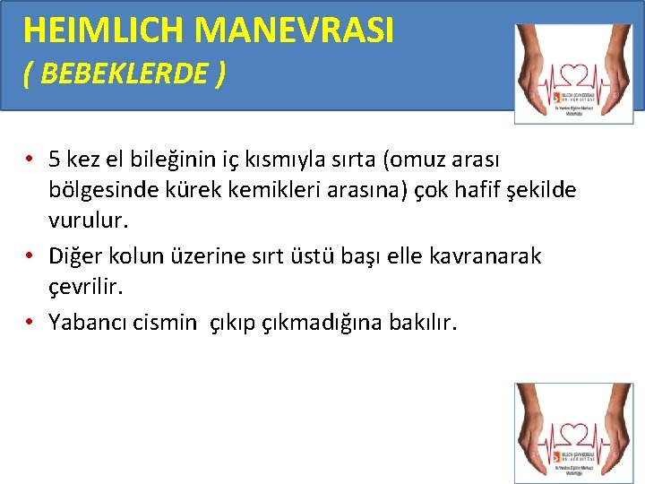 HEIMLICH MANEVRASI ( BEBEKLERDE ) • 5 kez el bileğinin iç kısmıyla sırta (omuz