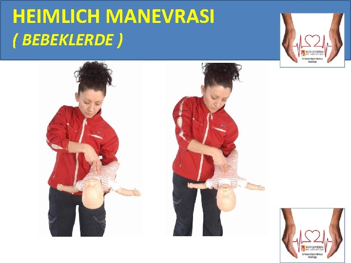 HEIMLICH MANEVRASI ( BEBEKLERDE ) 