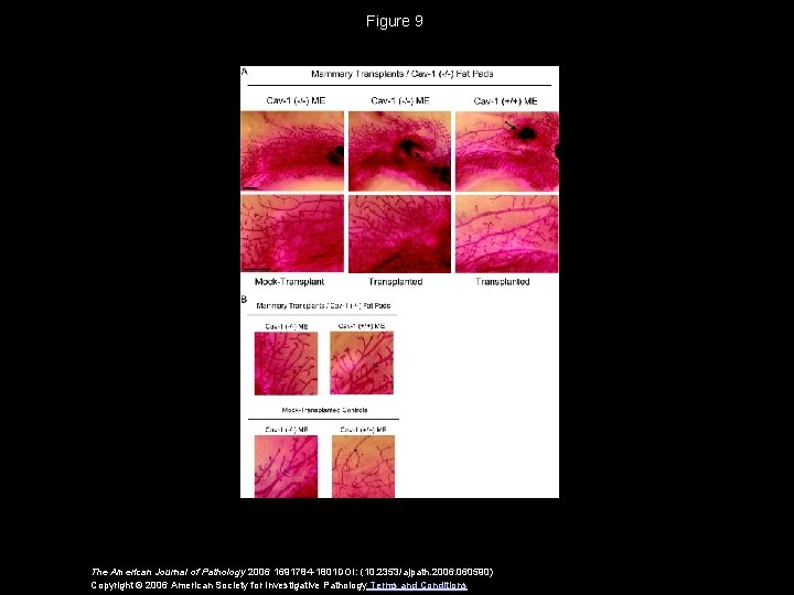 Figure 9 The American Journal of Pathology 2006 1691784 -1801 DOI: (10. 2353/ajpath. 2006.