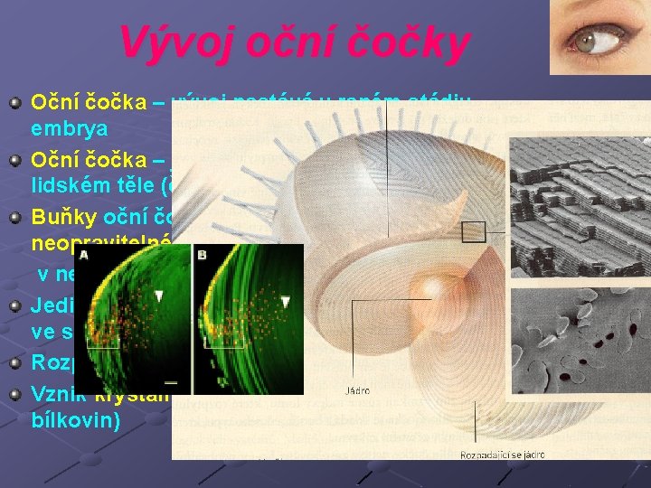 Vývoj oční čočky Oční čočka – vývoj nastává v raném stádiu embrya Oční čočka