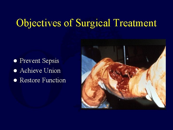 Objectives of Surgical Treatment Prevent Sepsis l Achieve Union l Restore Function l 