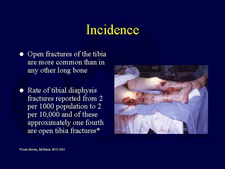 Incidence l Open fractures of the tibia are more common than in any other