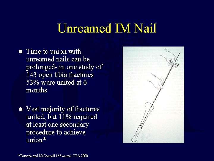 Unreamed IM Nail l Time to union with unreamed nails can be prolonged- in