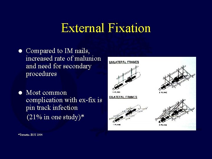 External Fixation l Compared to IM nails, increased rate of malunion and need for