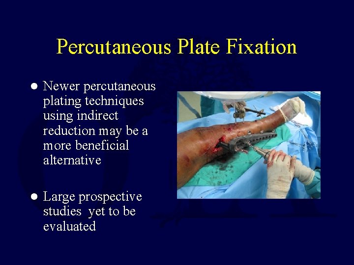 Percutaneous Plate Fixation l Newer percutaneous plating techniques using indirect reduction may be a