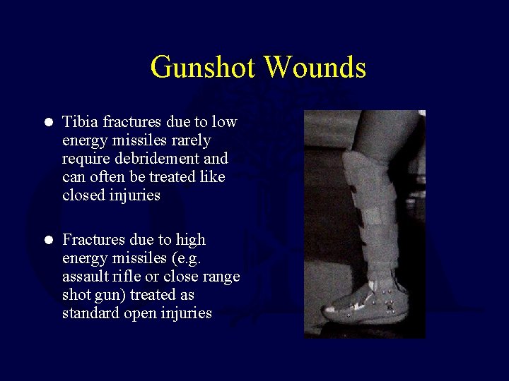 Gunshot Wounds l Tibia fractures due to low energy missiles rarely require debridement and