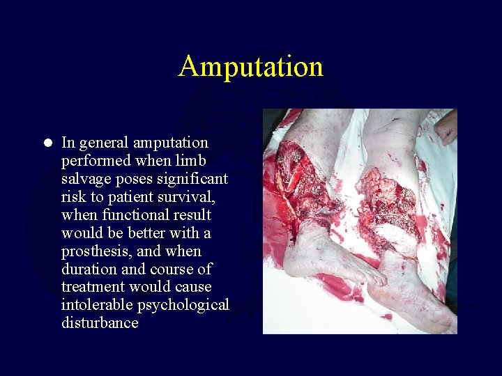 Amputation l In general amputation performed when limb salvage poses significant risk to patient