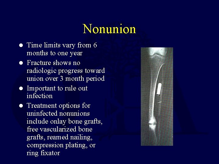 Nonunion Time limits vary from 6 months to one year l Fracture shows no