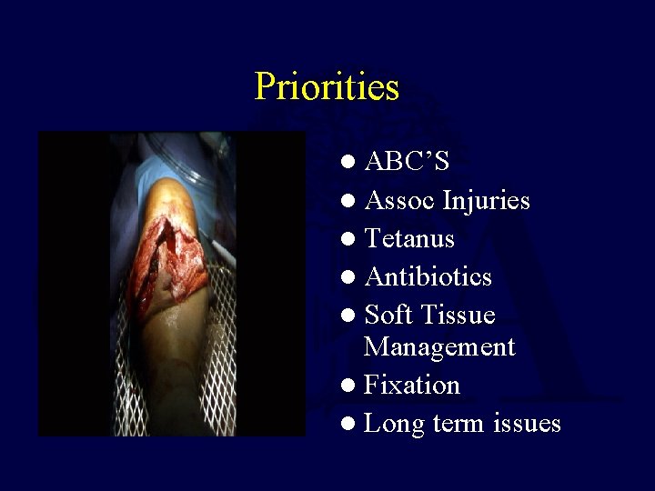 Priorities l ABC’S l Assoc Injuries l Tetanus l Antibiotics l Soft Tissue Management