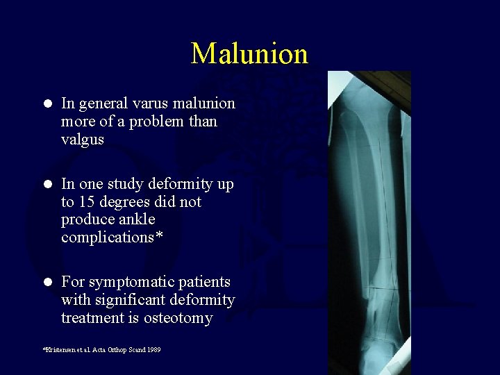 Malunion l In general varus malunion more of a problem than valgus l In