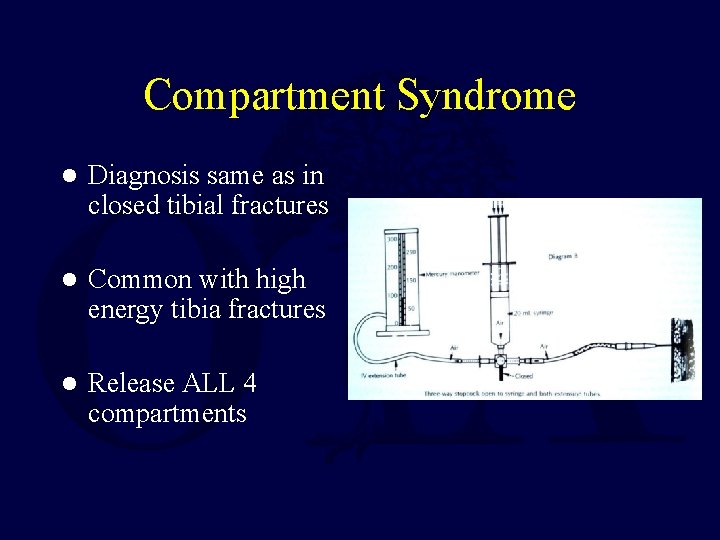 Compartment Syndrome l Diagnosis same as in closed tibial fractures l Common with high