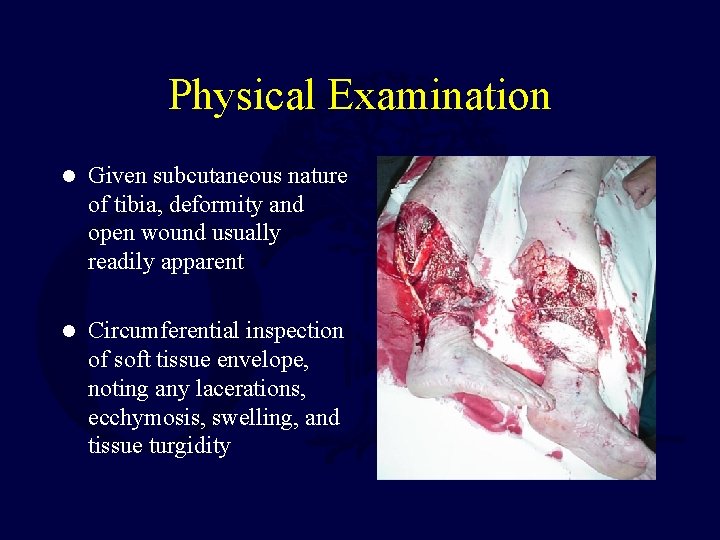 Physical Examination l Given subcutaneous nature of tibia, deformity and open wound usually readily