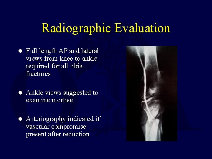 Radiographic Evaluation l Full length AP and lateral views from knee to ankle required