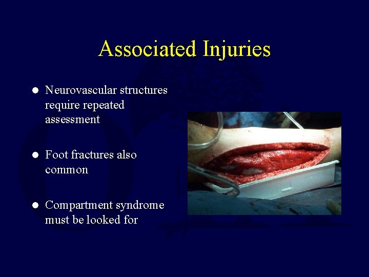Associated Injuries l Neurovascular structures require repeated assessment l Foot fractures also common l