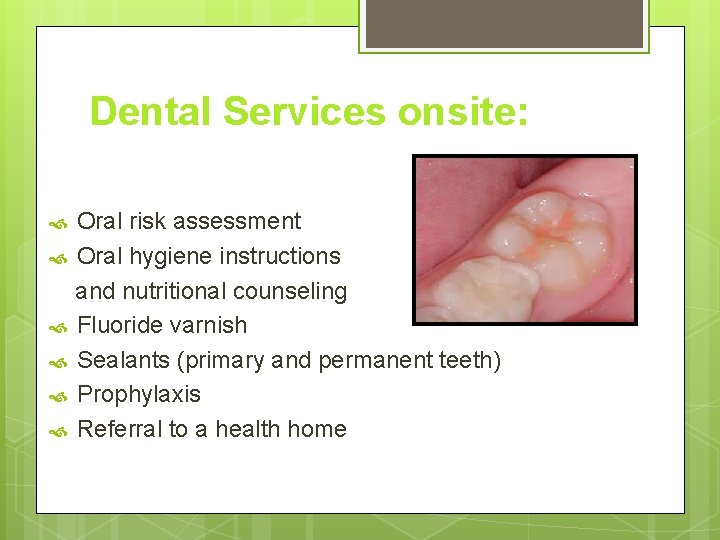Dental Services onsite: Oral risk assessment Oral hygiene instructions and nutritional counseling Fluoride varnish