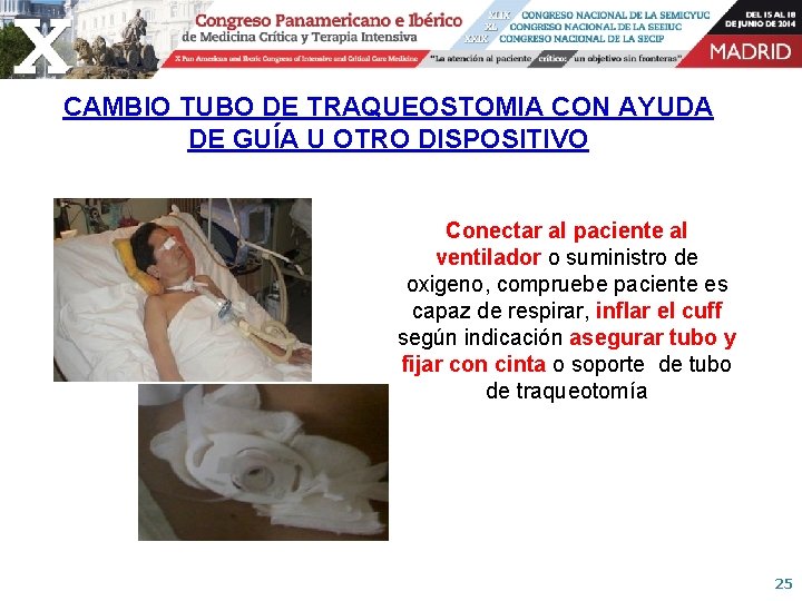 CAMBIO TUBO DE TRAQUEOSTOMIA CON AYUDA DE GUÍA U OTRO DISPOSITIVO Conectar al paciente