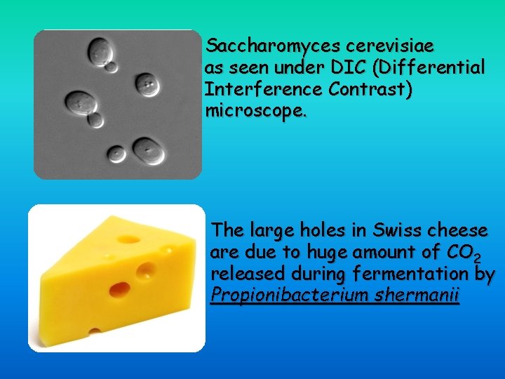 Saccharomyces cerevisiae as seen under DIC (Differential Interference Contrast) microscope. The large holes in