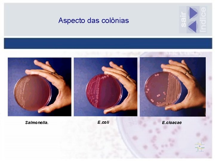 Aspecto das colônias Salmonella. E. coli E. cloacae 