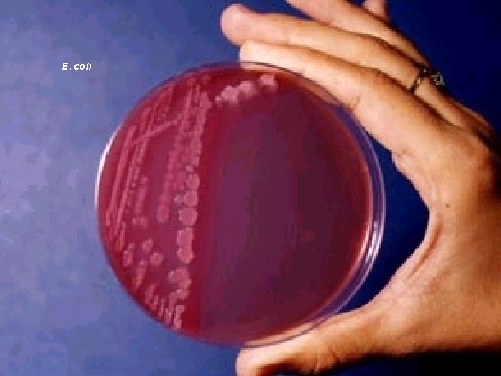 E. coli 
